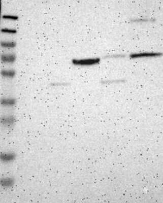 Western Blot: DACH1 Antibody [NBP3-17784]