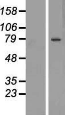 Western Blot: DACH1 Overexpression Lysate [NBP2-05764]