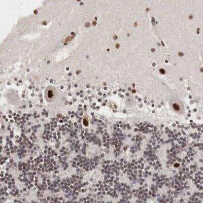 Immunohistochemistry-Paraffin: DACH2 Antibody [NBP1-89476]