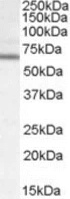 Western Blot: DACH2 Antibody [NBP1-00177]