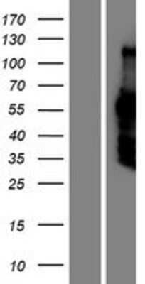 Western Blot: DACH2 Overexpression Lysate [NBP2-05817]