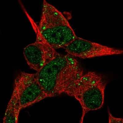 Immunocytochemistry/ Immunofluorescence: DACT3/Dapper 3 Antibody [NBP1-81196]