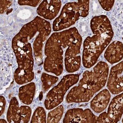 Immunohistochemistry-Paraffin: DACT3/Dapper 3 Antibody [NBP1-81196]