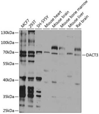 Immunohistochemistry-Paraffin: DACT3/Dapper 3 Antibody - BSA Free [NBP3-03293]