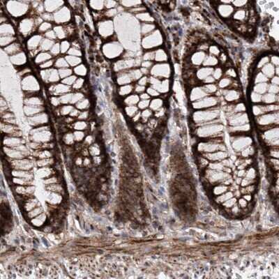 Immunohistochemistry-Paraffin: DAD1 Antibody [NBP1-82466]