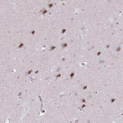 Immunohistochemistry-Paraffin: DAGLA Antibody [NBP2-31856]