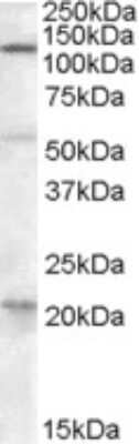 Western Blot: DAGLA Antibody [NBP1-20905]