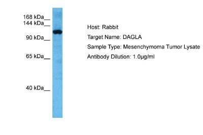 Western Blot: DAGLA Antibody [NBP2-84760]