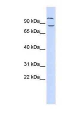 Western Blot: DAGLB Antibody [NBP1-69662]