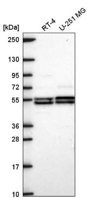 Western Blot: DAGLB Antibody [NBP2-57542]