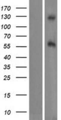 Western Blot: DAGLB Overexpression Lysate [NBP2-09676]