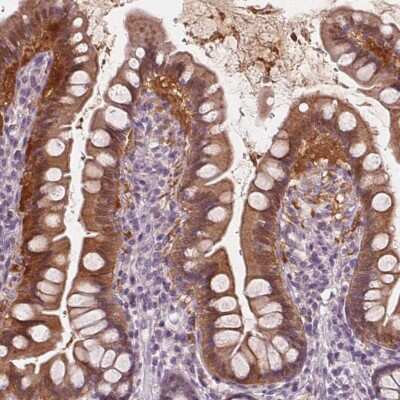 Immunohistochemistry: DAK Antibody [NBP2-48894]