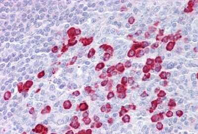 Immunohistochemistry-Paraffin: DAK Antibody [NBP1-54881]