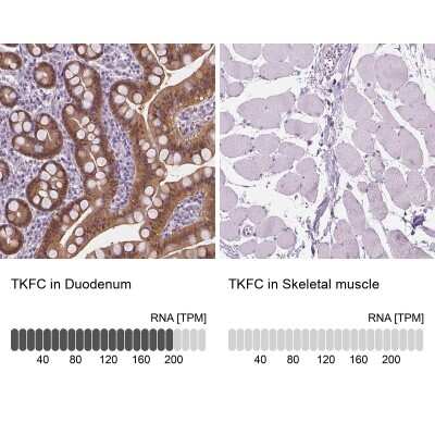 Immunohistochemistry-Paraffin: DAK Antibody [NBP1-84142]