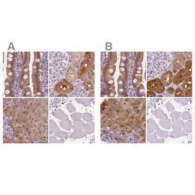 Immunohistochemistry-Paraffin: DAK Antibody [NBP2-48894]