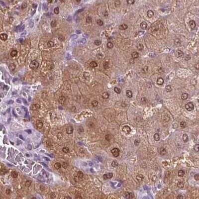 Immunohistochemistry-Paraffin: DAK Antibody [NBP2-48894]