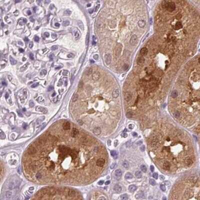 Immunohistochemistry-Paraffin: DAK Antibody [NBP2-48894]