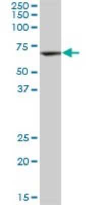 Western Blot: DAK Antibody [H00026007-B01P]