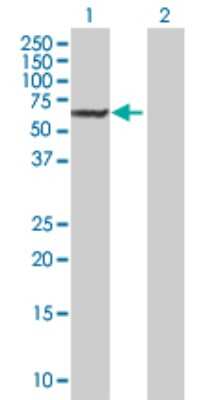 Western Blot: DAK Antibody [H00026007-B01P]