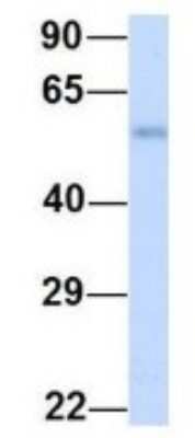 Western Blot: DAK Antibody [NBP1-54881]