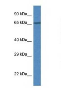 Western Blot: DAK Antibody [NBP1-79584]