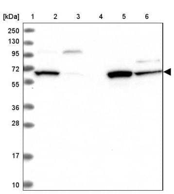 Western Blot: DAK Antibody [NBP1-84142]