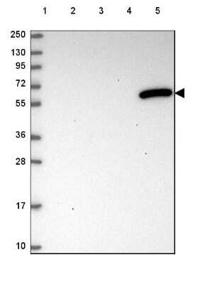 Western Blot: DAK Antibody [NBP2-48894]