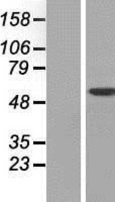 Western Blot: DAK Overexpression Lysate [NBP2-07153]