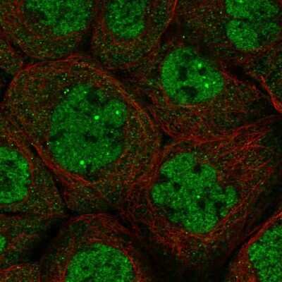 Immunocytochemistry/ Immunofluorescence: DALRD3 Antibody [NBP1-84622]