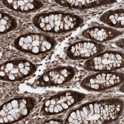 Immunohistochemistry-Paraffin: DALRD3 Antibody [NBP1-84622]