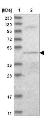 Western Blot: DALRD3 Antibody [NBP1-84622]