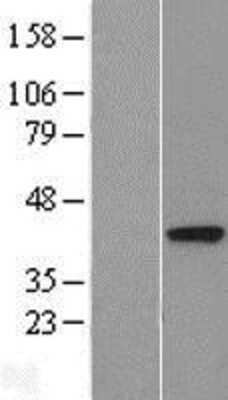 Western Blot: DALRD3 Overexpression Lysate [NBL1-09714]