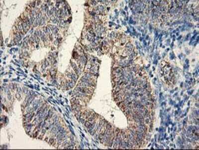 Immunohistochemistry-Paraffin: COCO/DAND5 Antibody (OTI2H3) [NBP2-01223]