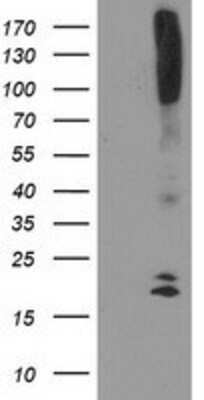 Western Blot: COCO/DAND5 Antibody (OTI2H3) [NBP2-01223]