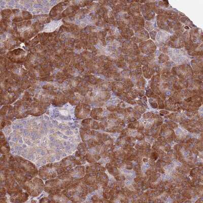 Immunohistochemistry-Paraffin: COCO/DAND5 Antibody [NBP2-13899]