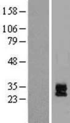 Western Blot: COCO/DAND5 Overexpression Lysate [NBP2-05324]