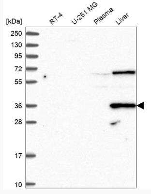 Western Blot: DAO Antibody [NBP1-84304]