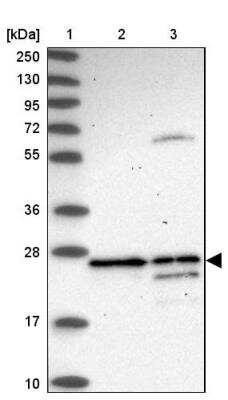 Western Blot: DAO Antibody [NBP1-84305]