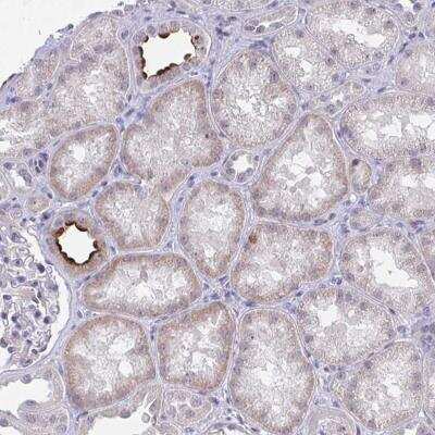 Immunohistochemistry-Paraffin: DAOA Antibody [NBP2-33675]