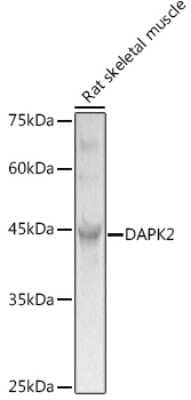 Western Blot: DAP Kinase 2 AntibodyAzide and BSA Free [NBP3-02982]