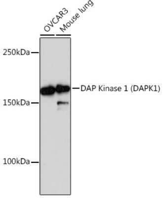 Western Blot: DAP Kinase 1 Antibody (3E10G3) [NBP3-15382]