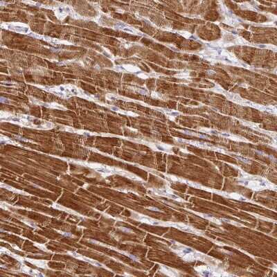 Immunohistochemistry-Paraffin: DAP Kinase 1 Antibody [NBP2-38580]