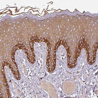 Immunohistochemistry-Paraffin: DAP Kinase 1 Antibody [NBP2-38468]