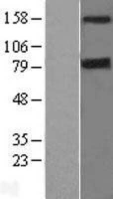 Western Blot: DAP Kinase 1 Overexpression Lysate [NBL1-09716]