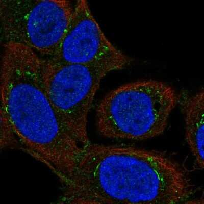 Immunocytochemistry/ Immunofluorescence: DAP Kinase 2 Antibody [NBP2-57307]