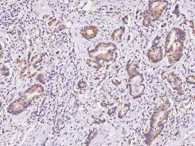 Immunohistochemistry-Paraffin: DAP Kinase 2 Antibody [NBP3-06183]