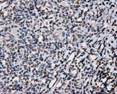 Immunohistochemistry: DAP Kinase 2 Antibody (OTI1C5) - Azide and BSA Free [NBP2-71753]