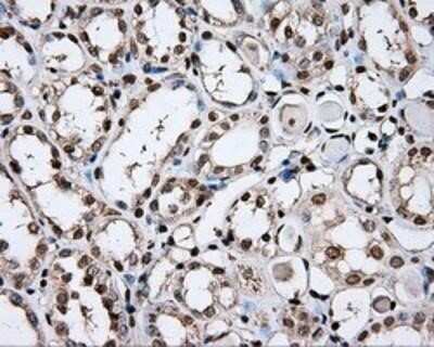 Immunohistochemistry: DAP Kinase 2 Antibody (OTI1C5) - Azide and BSA Free [NBP2-71753]