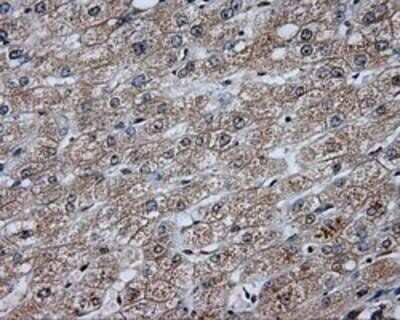 Immunohistochemistry: DAP Kinase 2 Antibody (OTI1C5) - Azide and BSA Free [NBP2-71753]