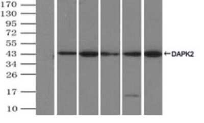 Immunoprecipitation: DAP Kinase 2 Antibody (OTI1C5) - Azide and BSA Free [NBP2-71753]